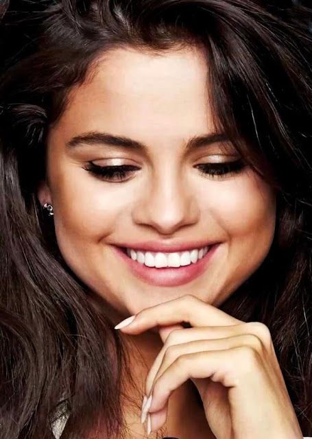 Selena Gomez before dental work